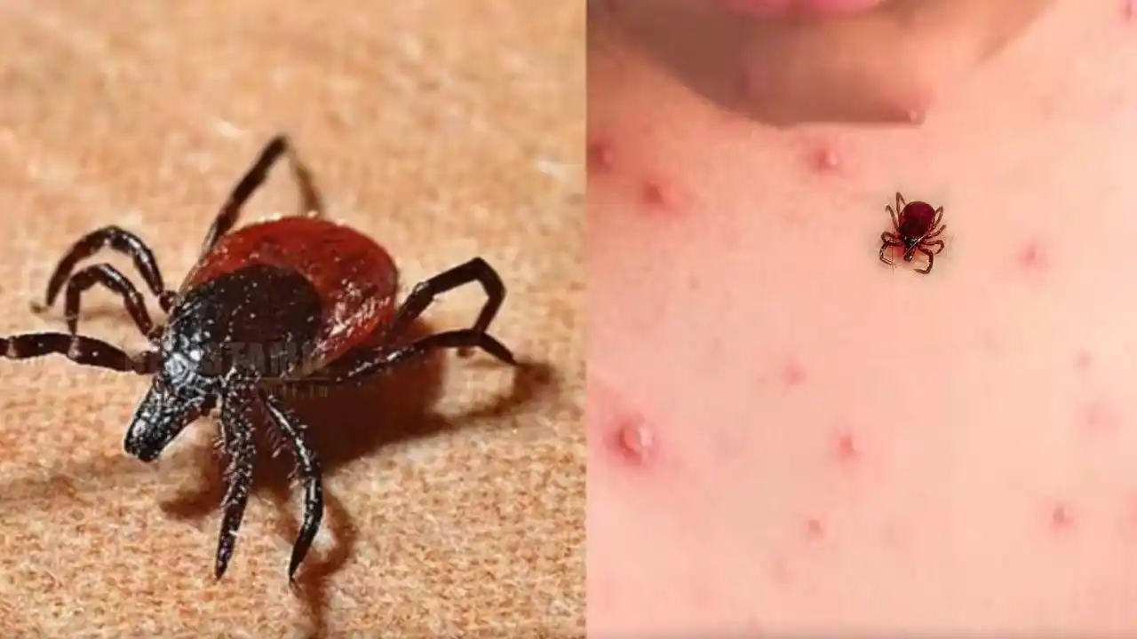 scrub-typhus-fever-august january tamil nadu health department